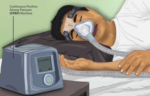 Sleep Apnea CPAP machines